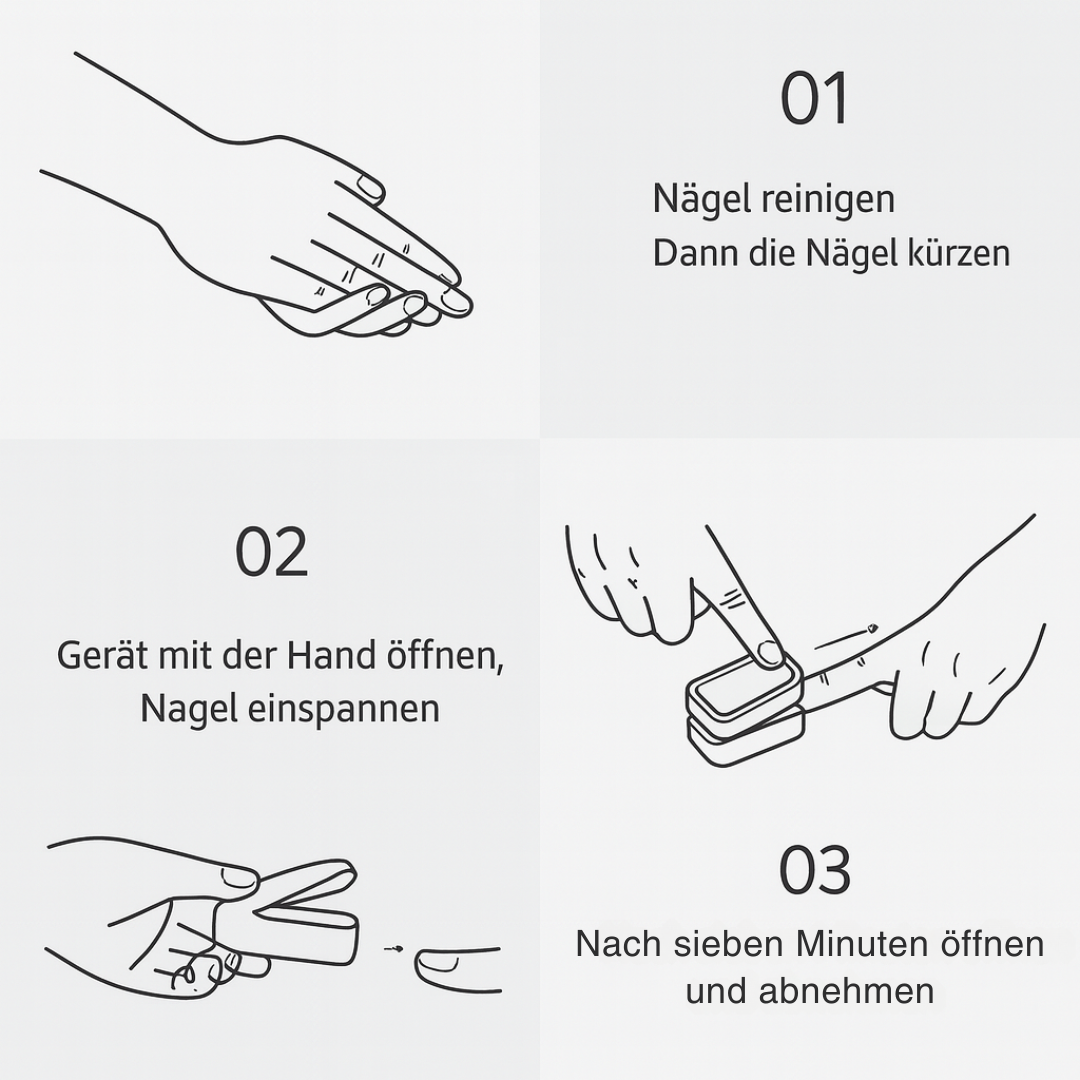 AurelyCare™ UV-Nageltherapiegerät