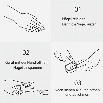 AurelyCare™ UV-Nageltherapiegerät