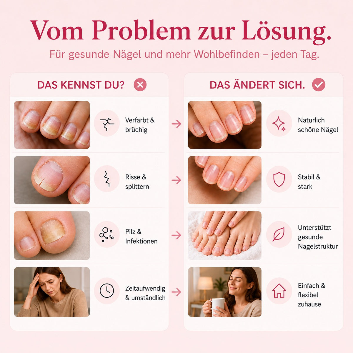 Aurely-Care™ UV-Nageltherapiegerät