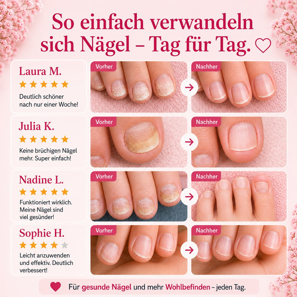 Aurely-Care™ UV-Nageltherapiegerät