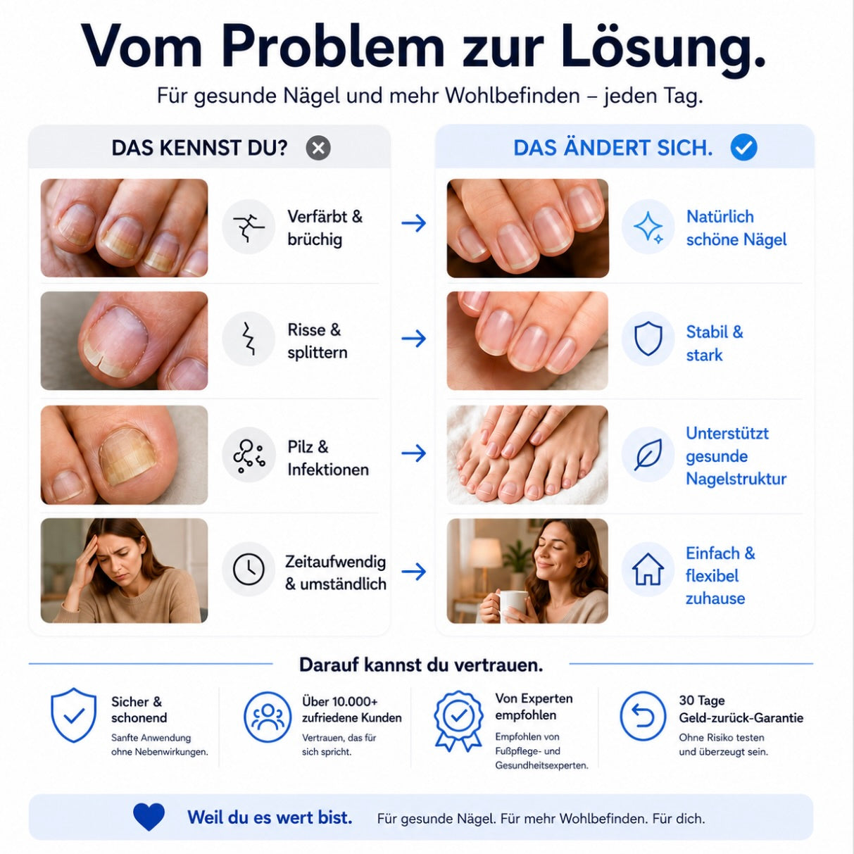 Aurely-Care™ UV-Nageltherapiegerät