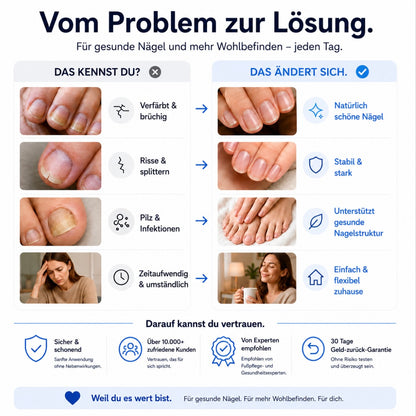 Aurely-Care™ UV-Nageltherapiegerät