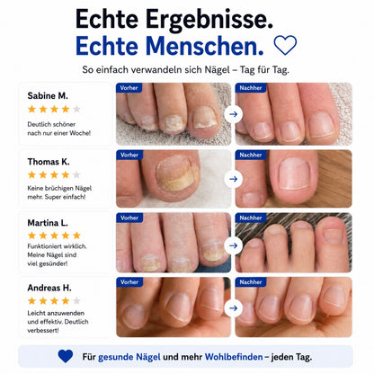 Aurely-Care™ UV-Nageltherapiegerät